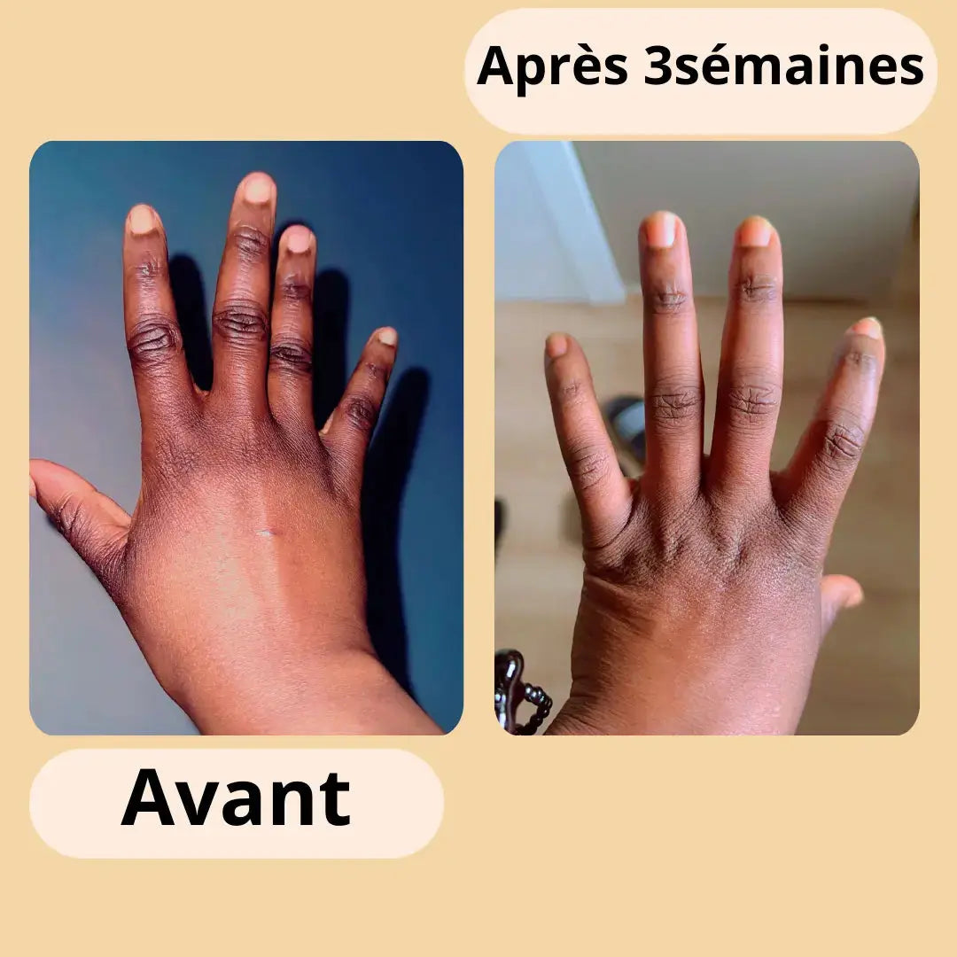 photo avant et après yole beauty