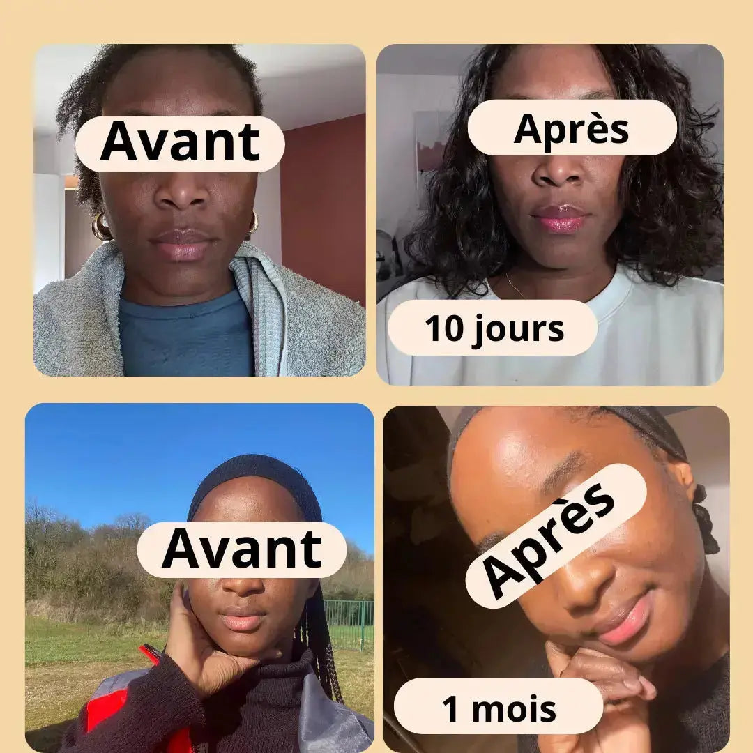 Crème visage éclaircissante